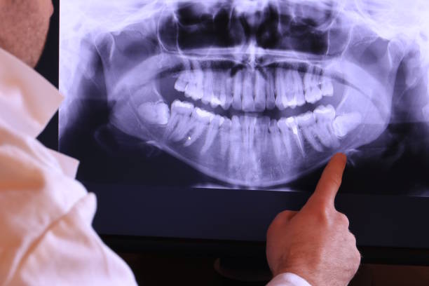 Best Emergency Dental Services for Seniors in Warren, PA